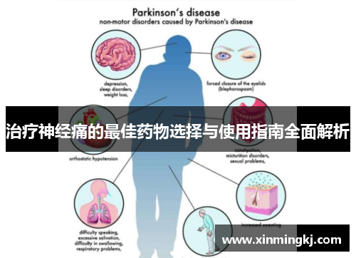 治疗神经痛的最佳药物选择与使用指南全面解析